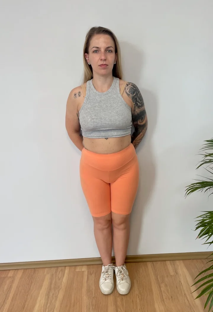 Karolina - zdjęcie przed