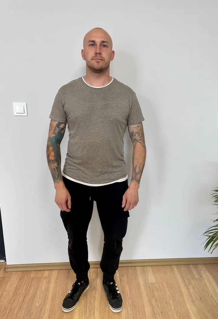 Łukasz - zdjęcie przed